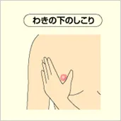 わきの下のしこり