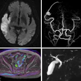 MRI(GE社製 SIGNA Pioneer 3T)